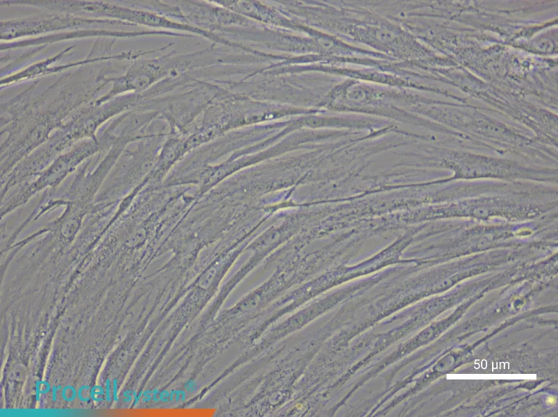 Human Glomerular Mesangial Cell Complete Medium - small - 5