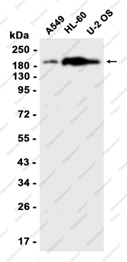 Recombinant SMARCA2/BRM Monoclonal Antibody - 1