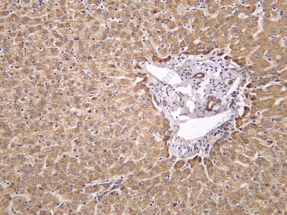 Recombinant Acetyl Lysine Monoclonal Antibody - 1