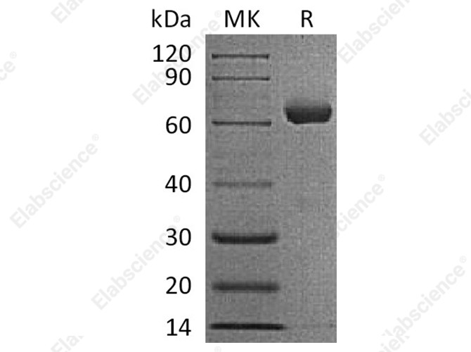 Recombinant Human IGSF11/BTIGSF Protein (Fc Tag) - 1