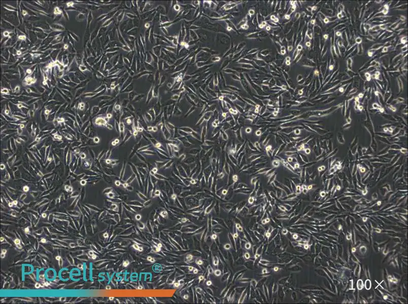 NUGC-3 Cell Complete Medium - 1