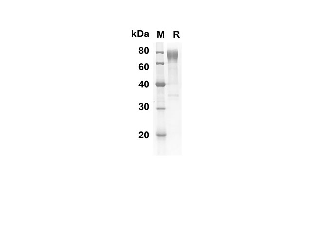 Recombinant Rat IL-1b Protein(Trx Tag)-产品推荐-1