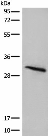 Western blot analysis of Mouse lung tissue lysate  using ITM2B Polyclonal Antibody at dilution of 1:400