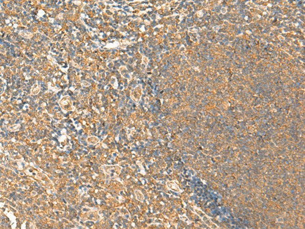 Immunohistochemistry of paraffin-embedded Human tonsil tissue  using HTT Polyclonal Antibody at dilution of 1:25(?200)