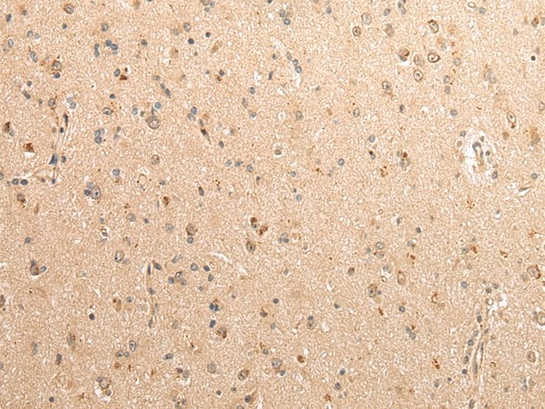 Immunohistochemistry of paraffin-embedded Human brain using SDCBP Polyclonal Antibody at dilution of  1/40