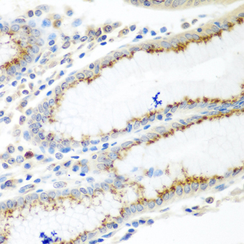 Immunohistochemistry of paraffin-embedded human stomach using UBIAD1 Polyclonal antibody at dilution of 1:100 (40x lens).Perform microwave antigen retrieval with 10 mM PBS buffer pH 7.2 before commencing with IHC staining protocol.