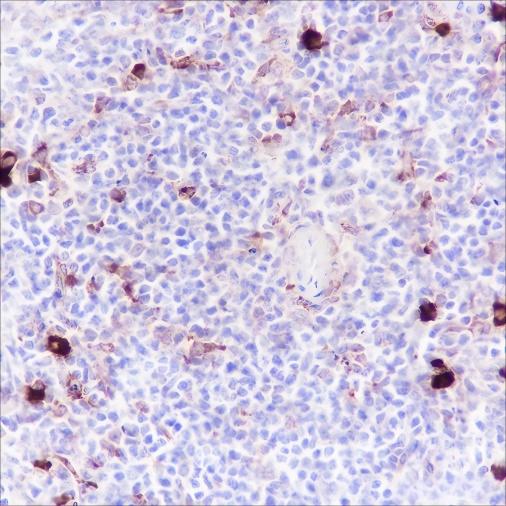 Recombinant Phospho-S6 Ribosomal Protein (Ser240, 244) Monoclonal Antibody - small - 4