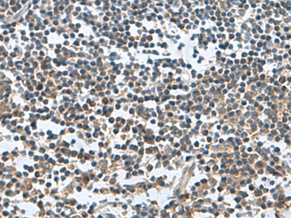 Immunohistochemistry of paraffin-embedded Human tonsil tissue  using FAM107B Polyclonal Antibody at dilution of 1:150(?200)