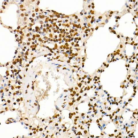 Immunohistochemistry of paraffin-embedded rat lung using Histone H4 Polyclonal antibody at dilution of 1:250 (40x lens).Perform high pressure antigen retri