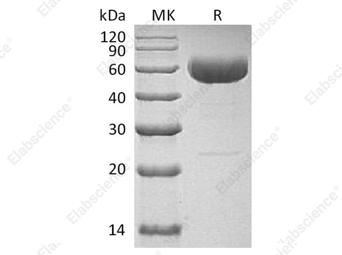 Recombinant Human Interleukin-22/IL-22 Protein (C-hIgG4 Fc) - 1