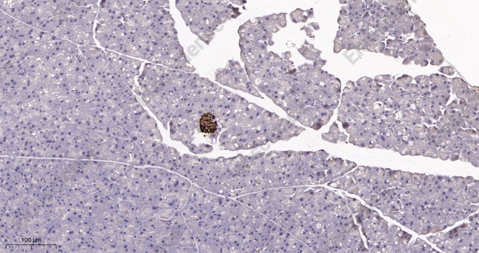 Recombinant Chromogranin A Monoclonal Antibody - 3