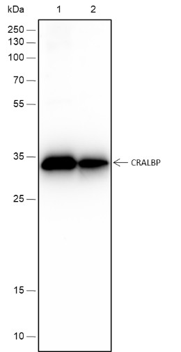Recombinant CRALBP Monoclonal Antibody-searchlist-1