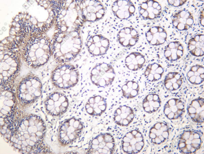Recombinant Cortactin Monoclonal Antibody - 1