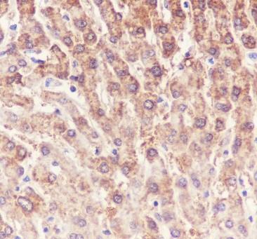 Recombinant ALDH7A1 Monoclonal Antibody - 3