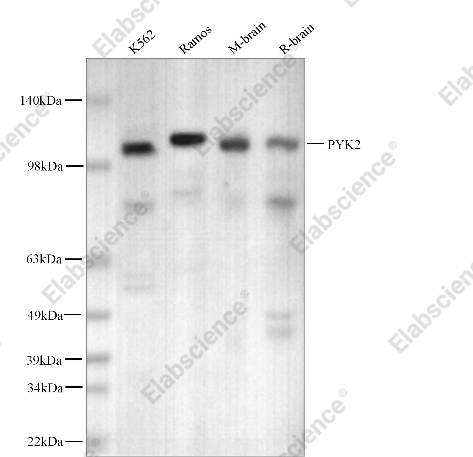 Recombinant PYK2 Monoclonal Antibody - 1