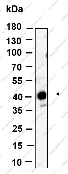 Recombinant FBX32 Monoclonal Antibody - 1