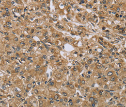 TXLNA Polyclonal Antibody - 2
