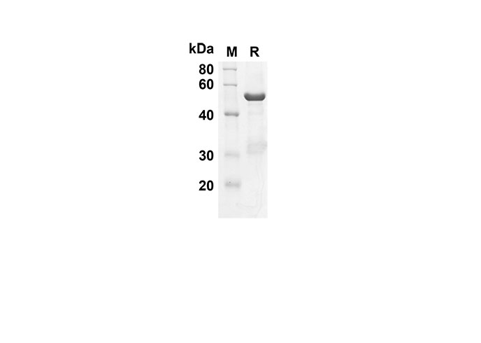 Recombinant Mouse IL-11 Protein(Trx Tag)-产品推荐-1