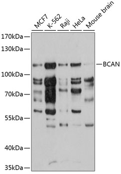 Western blot analysis of extracts of various cell lines using BCAN Polyclonal Antibody at 1:3000 dilution.