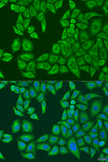 Immunofluorescence analysis of U2OS cells using ABCF2 Polyclonal Antibody at dilution of 1:100. Blue: DAPI for nuclear staining.