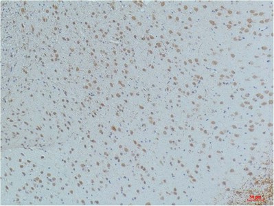 Immunohistochemistry of paraffin-embedded Mouse brain tissue using Phospho-CAMK2 beta/gamma/delta (Thr287) Monoclonal Antibody at dilution of 1:200.