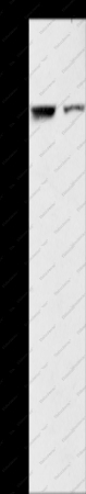 ARHGAP15 Polyclonal Antibody - 1