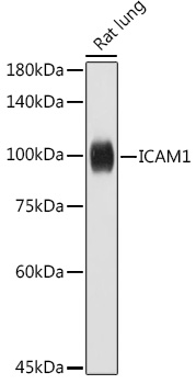 Western blot analysis of extracts of Rat lung using ICAM1 Polyclonal Antibody at 1:1000 dilution.