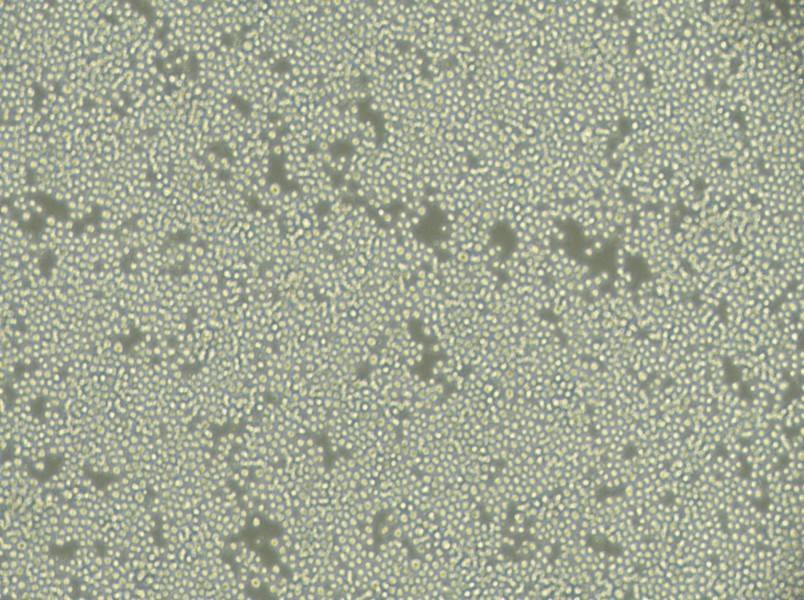 P3/NSI/1-Ag4-1 [NS-1] Cell Complete Medium - 2