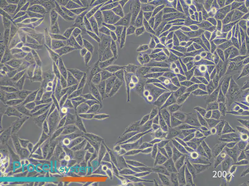 SiHa Cell Complete Medium - small - 6