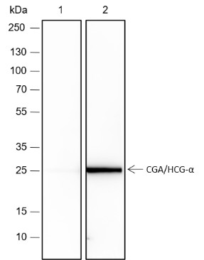 Recombinant CGA/hCG alpha Monoclonal Antibody-searchlist-1