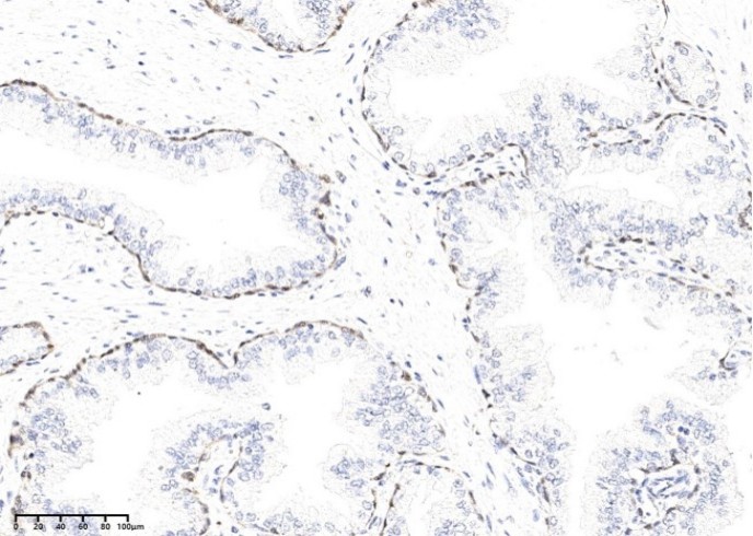 KLK15 Monoclonal Antibody - small - 1