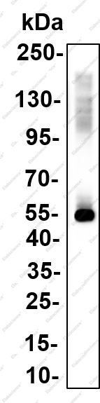 Recombinant FLI1 Monoclonal Antibody - 2