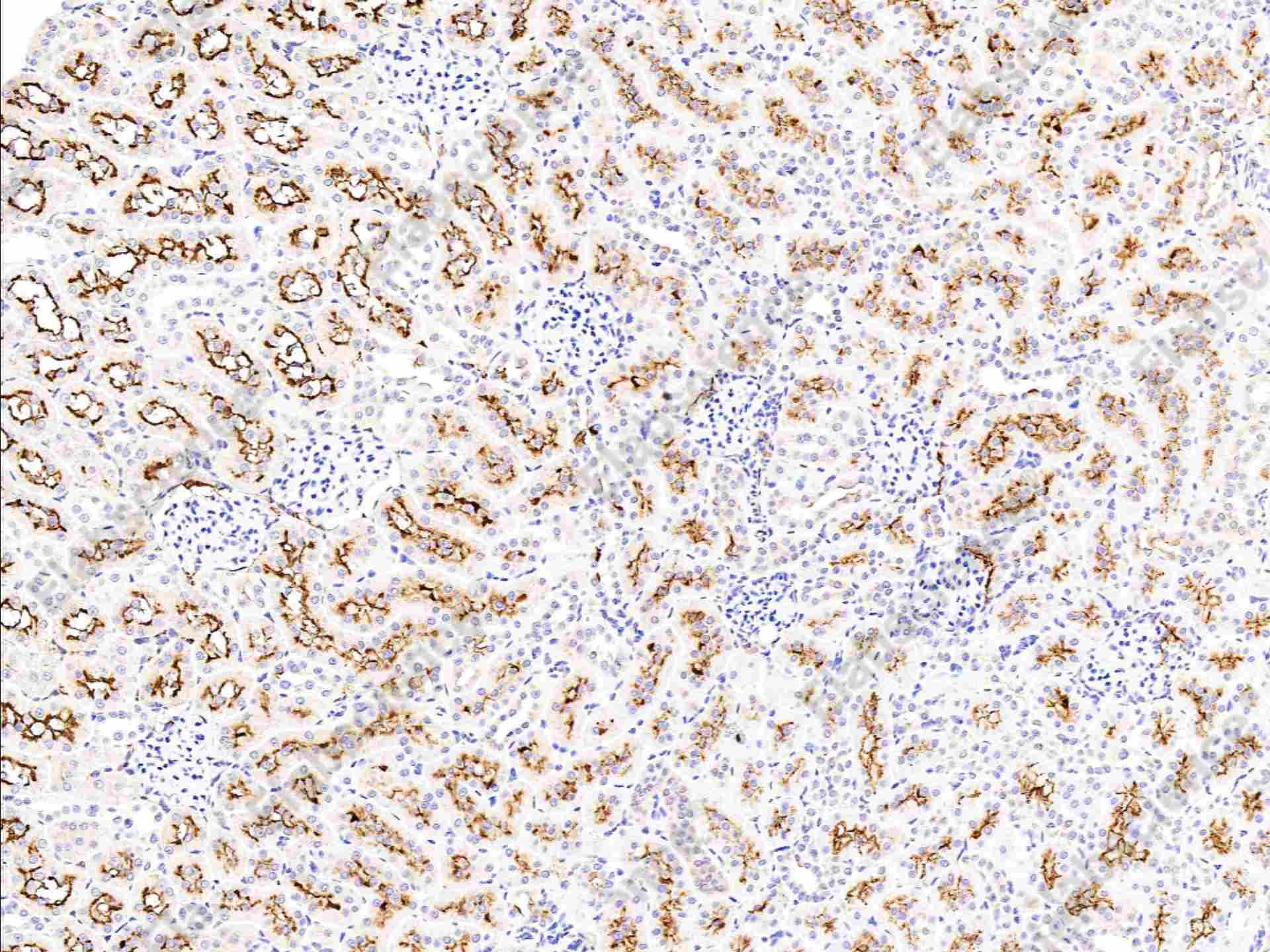 Recombinant CD13/ANPEP Monoclonal Antibody - 2