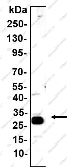 Recombinant Bcl-10 Monoclonal Antibody - 1
