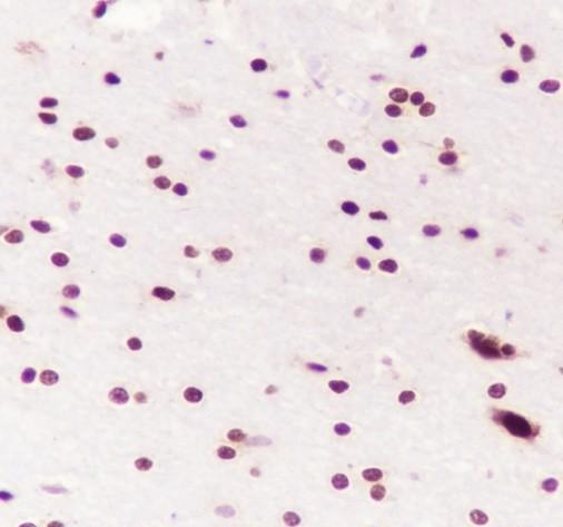 Recombinant SMARCA2/BRM Monoclonal Antibody - 2