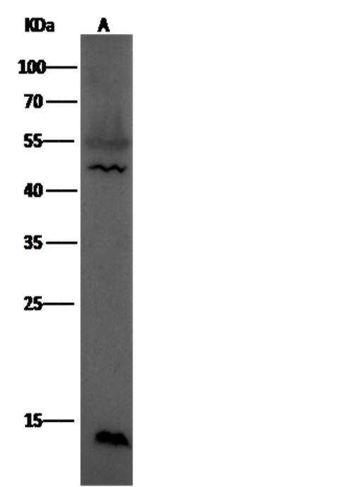 Leptin/LEP Monoclonal Antibody - small - 1
