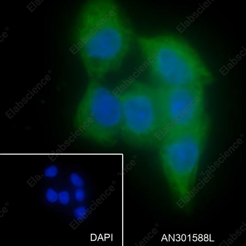 Recombinant LPCAT1 Monoclonal Antibody - 4