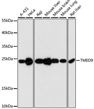 Western blot analysis of extracts of various cell lines using TMED9 Polyclonal Antibody at dilution of 1:3000.