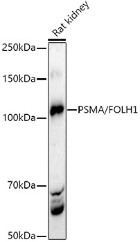 Western blot analysis of extracts of Rat kidney using PSMA/FOLH1 Polyclonal Antibody at 1:500 dilution.