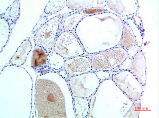 Immunohistochemistry of paraffin-embedded Human Thyroid tissue using TTR Monoclonal Antibody at dilution of 1:200.