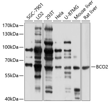 Western blot analysis of extracts of various cell lines using BCO2 Polyclonal Antibody at 1:1000 dilution.