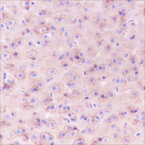 Recombinant Prion protein PrP Monoclonal Antibody - small - 3