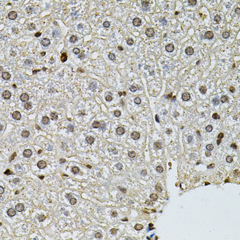 Immunohistochemistry of paraffin-embedded Mouse liver using PNKP Polyclonal Antibody at dilution of  1:100 (40x lens).