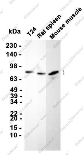 Recombinant Phospho-YAP1 (Ser127) Monoclonal Antibody - 1