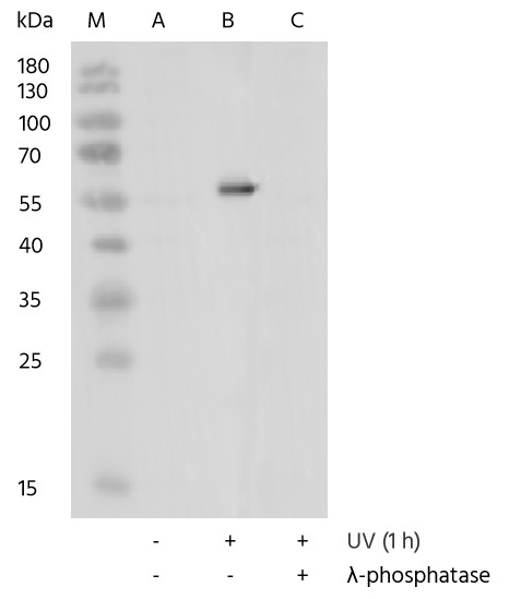 Recombinant Phospho-Chk1 (Ser317) Monoclonal Antibody - small - 4