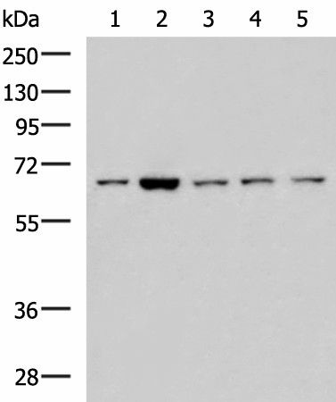 Western blot analysis of 293T LOVO Hela and Jurkat cell lysates  using CHEK2 Polyclonal Antibody at dilution of 1:600