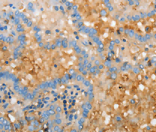 APOH Polyclonal Antibody - 2