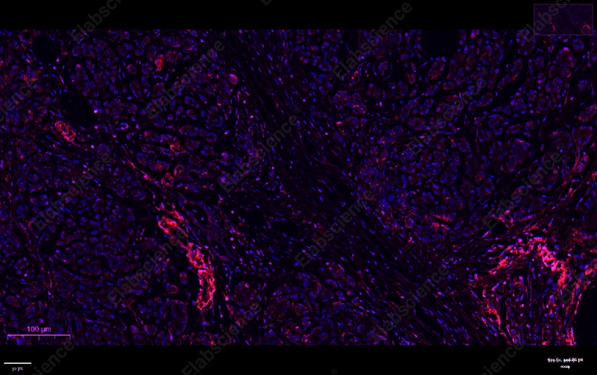 Recombinant PLCG1 Monoclonal Antibody - 5