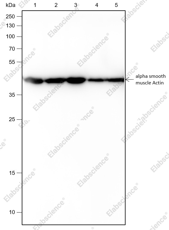 Recombinant alpha smooth muscle Actin Monoclonal Antibody - 1