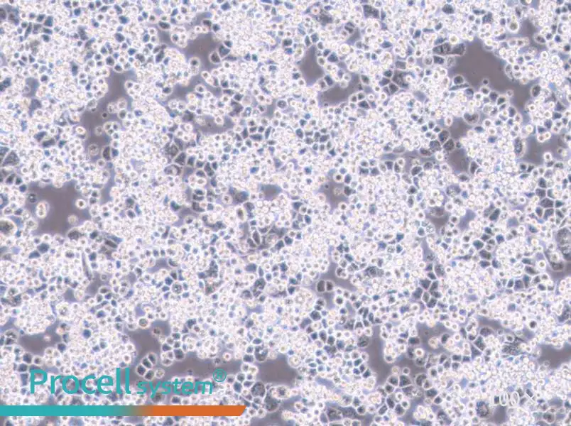 MDA-kb2 (L15) Cell Complete Medium - 1